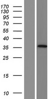 AADACL3 Human Over-expression Lysate