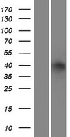 ADH6 Human Over-expression Lysate