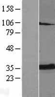 Adenine Nucleotide Translocator 2 (SLC25A5) Human Over-expression Lysate