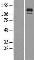 BMPR2 Human Over-expression Lysate