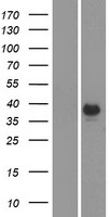 CA6 Human Over-expression Lysate