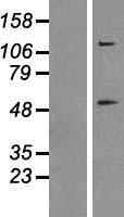 Caspase 8 (CASP8) Human Over-expression Lysate