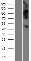 OVCA1 (DPH1) Human Over-expression Lysate