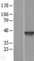 DNase II (DNASE2) Human Over-expression Lysate