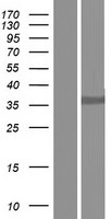 D Box Binding Protein (DBP) Human Over-expression Lysate