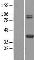 GMDS Human Over-expression Lysate