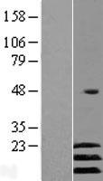 ATF3 Human Over-expression Lysate