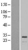 ATP6V1E1 Human Over-expression Lysate