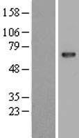 Arylsulfatase D (ARSD) Human Over-expression Lysate