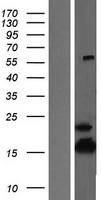 ATP5F1D Human Over-expression Lysate