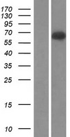 Complement C9 (C9) Human Over-expression Lysate