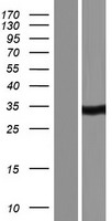 CA5A Human Over-expression Lysate