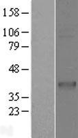 CD1C Human Over-expression Lysate