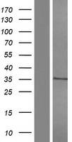 CD1 (CD1A) Human Over-expression Lysate