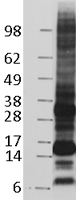 CD52 Human Over-expression Lysate