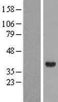 AKR1C4 Human Over-expression Lysate