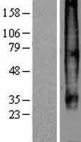 CCR7 Human Over-expression Lysate