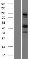 Collagen IX (COL9A1) Human Over-expression Lysate