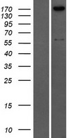 Collagen IV (COL4A2) Human Over-expression Lysate