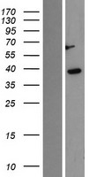 Casein Kinase 1 alpha (CSNK1A1) Human Over-expression Lysate