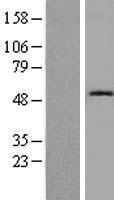 Cystatin SN (CST1) Human Over-expression Lysate