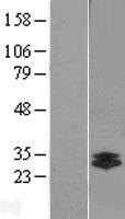 Chymotrypsin like protease (CTRL) Human Over-expression Lysate