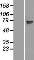 CTP synthase (CTPS1) Human Over-expression Lysate