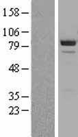 beta Catenin (CTNNB1) Human Over-expression Lysate