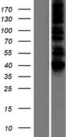 DLST Human Over-expression Lysate