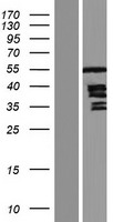 Thymidine Phosphorylase (TYMP) Human Over-expression Lysate