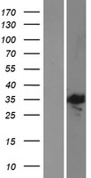 E2F5 Human Over-expression Lysate
