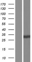 CELA1 Human Over-expression Lysate