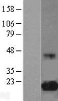 EIF5A Human Over-expression Lysate