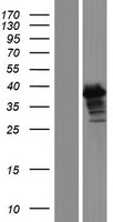 ERCC1 Human Over-expression Lysate