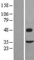 Fibromodulin (FMOD) Human Over-expression Lysate