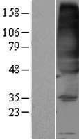FVT1 (KDSR) Human Over-expression Lysate