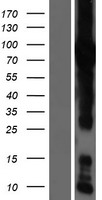 GFPT1 Human Over-expression Lysate