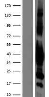 G protein alpha inhibitor 1 (GNAI1) Human Over-expression Lysate