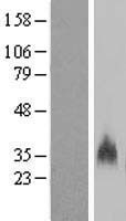 GYPB Human Over-expression Lysate