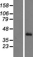 CFHL1 (CFHR1) Human Over-expression Lysate