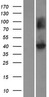 Kir4.1 (KCNJ10) Human Over-expression Lysate