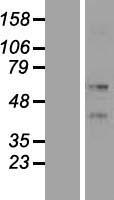 KRT86 Human Over-expression Lysate