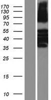 KRT81 Human Over-expression Lysate