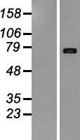 LIFR Human Over-expression Lysate