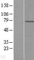 LRCH4 Human Over-expression Lysate
