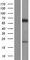 ME2 Human Over-expression Lysate