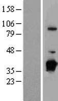 NUBP1 Human Over-expression Lysate