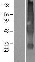 Solute carrier family 22 member 18 (SLC22A18) Human Over-expression Lysate
