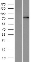 TBC1D25 Human Over-expression Lysate