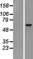 PHKA1 Human Over-expression Lysate
